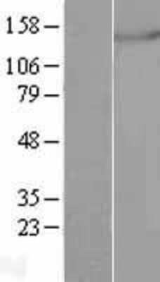 Western Blot: mtRNA polymerase Overexpression Lysate [NBL1-14597]