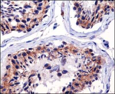 Immunohistochemistry: mtTFA Antibody (18G102B2E11) - Azide and BSA Free [NBP2-80858]