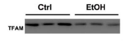 Western Blot: mtTFA Antibody (18G102B2E11)Azide and BSA Free [NBP2-80858]