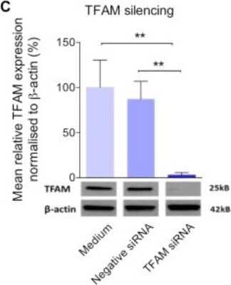 Knockdown Validated: mtTFA Antibody (18G102B2E11) [NBP1-71648]
