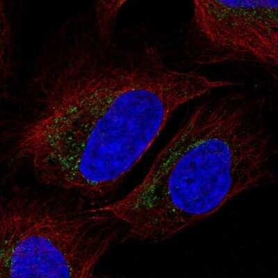 Immunocytochemistry/ Immunofluorescence: mtTFA Antibody [NBP1-86959]
