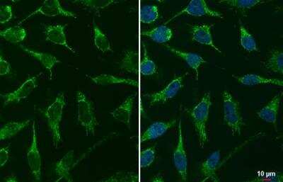 Immunocytochemistry/ Immunofluorescence: mtTFA Antibody [NBP2-19438]