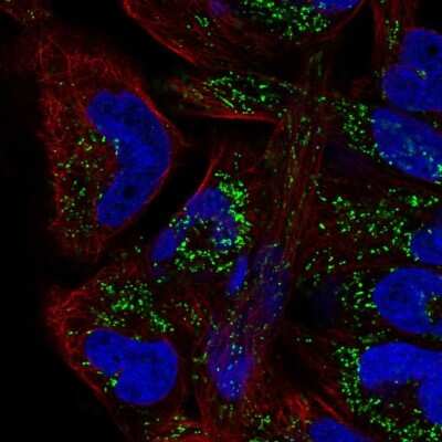 Immunocytochemistry/ Immunofluorescence: mtTFA Antibody [NBP2-56077]