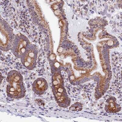 Immunohistochemistry-Paraffin: mtTFA Antibody [NBP1-86959]