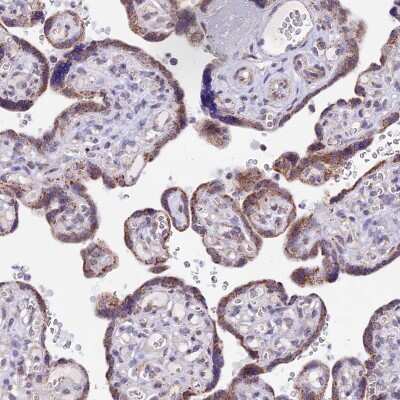 Immunohistochemistry-Paraffin: mtTFA Antibody [NBP1-86959]