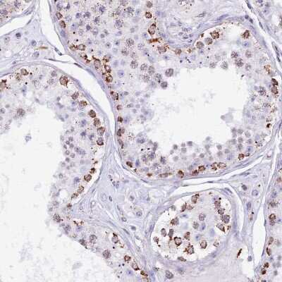 Immunohistochemistry-Paraffin: mtTFA Antibody [NBP1-86959]