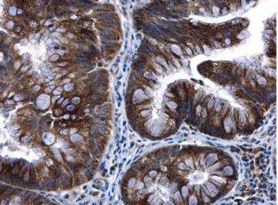 Immunohistochemistry-Paraffin: mtTFA Antibody [NBP2-19437]