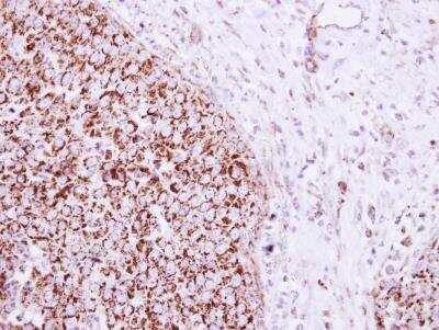 Immunohistochemistry-Paraffin: mtTFA Antibody [NBP2-19438]