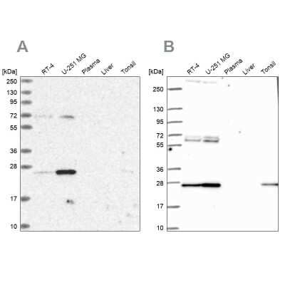 Western Blot: mtTFA Antibody [NBP1-86959]