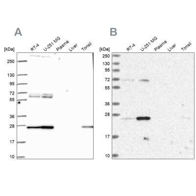 Western Blot: mtTFA Antibody [NBP2-56077]