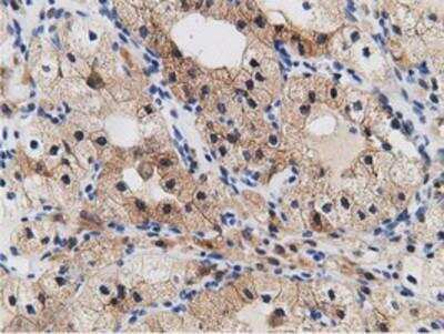 Immunohistochemistry-Paraffin: mu Crystallin Antibody (OTI1G7) [NBP2-02829]