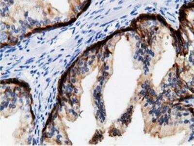 Immunohistochemistry-Paraffin: mu Crystallin Antibody (OTI1G7) [NBP2-02829]