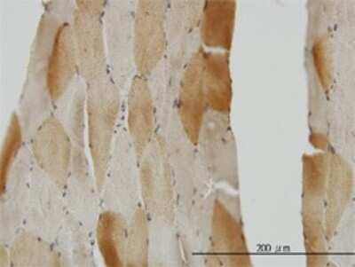 Immunohistochemistry-Paraffin: mu Crystallin Antibody (6B3) [H00001428-M03]