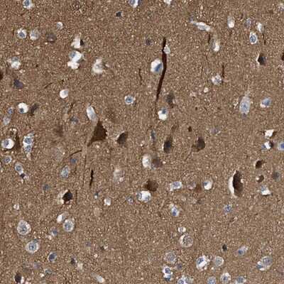Immunohistochemistry-Paraffin: mu Crystallin Antibody [NBP1-85241]
