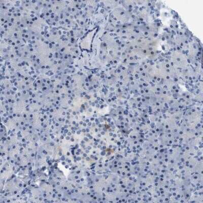 Immunohistochemistry-Paraffin: mu Crystallin Antibody [NBP1-85241]