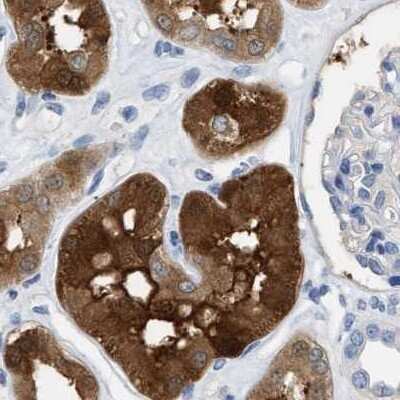 Immunohistochemistry-Paraffin: mu Crystallin Antibody [NBP1-85241]