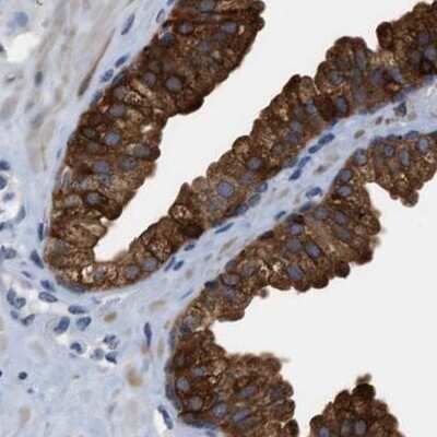 Immunohistochemistry-Paraffin: mu Crystallin Antibody [NBP1-85241]