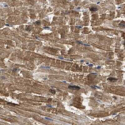 Immunohistochemistry-Paraffin: mu Crystallin Antibody [NBP1-85241]