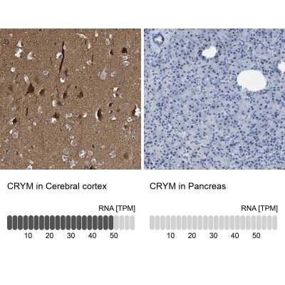 Immunohistochemistry-Paraffin: mu Crystallin Antibody [NBP1-85241]