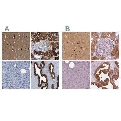 Immunohistochemistry-Paraffin: mu Crystallin Antibody [NBP1-85241]