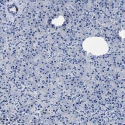 Immunohistochemistry-Paraffin: mu Crystallin Antibody [NBP1-85241]