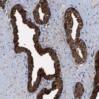 Immunohistochemistry-Paraffin: mu Crystallin Antibody [NBP1-85241]