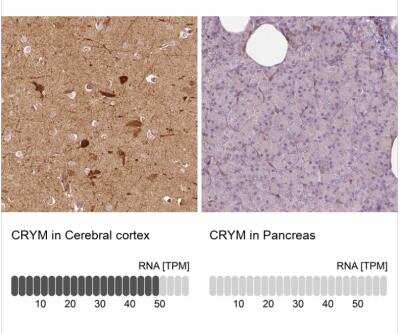 Immunohistochemistry-Paraffin: mu Crystallin Antibody [NBP2-55172]