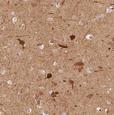 Immunohistochemistry-Paraffin: mu Crystallin Antibody [NBP2-55172]