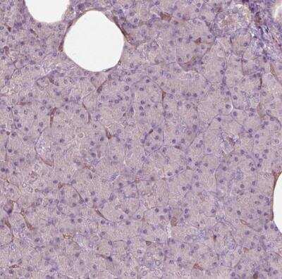 Immunohistochemistry-Paraffin: mu Crystallin Antibody [NBP2-55172]