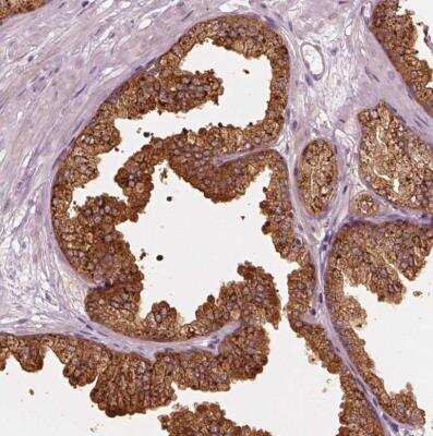 Immunohistochemistry-Paraffin: mu Crystallin Antibody [NBP2-55172]