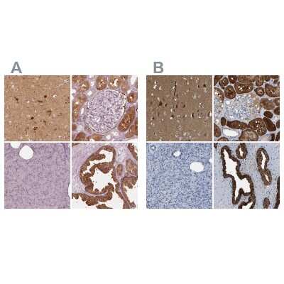Immunohistochemistry-Paraffin: mu Crystallin Antibody [NBP2-55172]