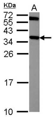 Western Blot: mu Crystallin Antibody [NBP1-31994]