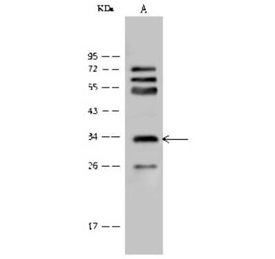 Western Blot: mu Crystallin Antibody [NBP2-99358]