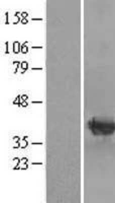 Western Blot: mu Crystallin Overexpression Lysate [NBL1-09503]