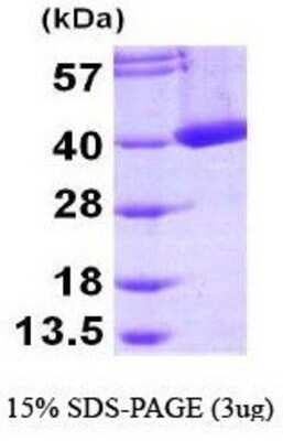 SDS-PAGE: Recombinant Human mu Crystallin His Protein [NBP1-44383]