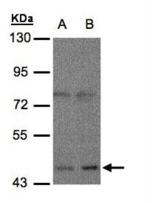 Western Blot: mu Opioid R/OPRM1 Antibody [NBP1-31180]