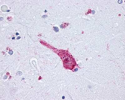 Immunohistochemistry-Paraffin: mu Opioid R/OPRM1 Antibody - BSA Free [NLS234]