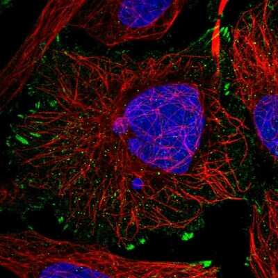 Immunocytochemistry/ Immunofluorescence: mut-7 Antibody [NBP1-92155]