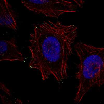 Immunocytochemistry/ Immunofluorescence: myosin X Antibody (CL8994) [NBP2-88926]