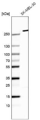 Western Blot: myosin X Antibody (CL9025) [NBP2-88927]