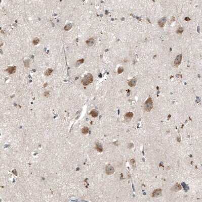 Immunohistochemistry-Paraffin: myosin X Antibody (CL9032) [NBP2-88928]