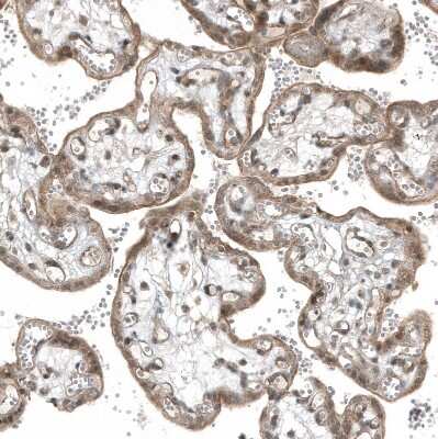 Immunohistochemistry-Paraffin: myosin X Antibody (CL9032) [NBP2-88928]