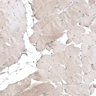 Immunohistochemistry-Paraffin: myosin X Antibody (CL9032) [NBP2-88928]