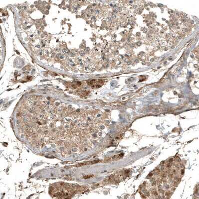 Immunohistochemistry-Paraffin: myosin X Antibody (CL9032) [NBP2-88928]