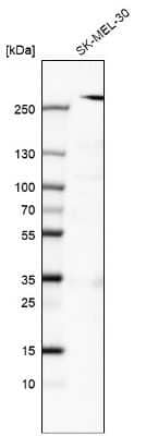 Western Blot: myosin X Antibody (CL9032) [NBP2-88928]