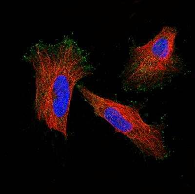 Immunocytochemistry/ Immunofluorescence: myosin X Antibody [NBP1-87748]