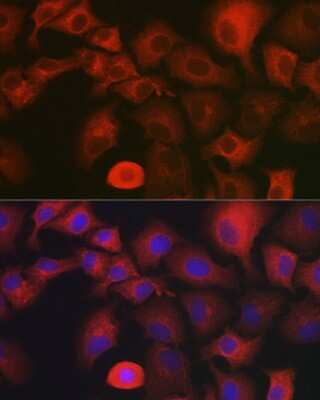 Immunocytochemistry/ Immunofluorescence: myosin X Antibody - BSA Free [NBP2-94085]
