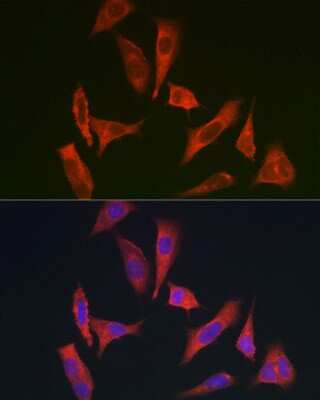 Immunocytochemistry/ Immunofluorescence: myosin X Antibody - BSA Free [NBP2-94085]