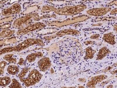 Immunohistochemistry-Paraffin: myosin X Antibody [NBP2-98105]