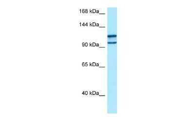 Western Blot: myosin X Antibody [NBP2-85352]